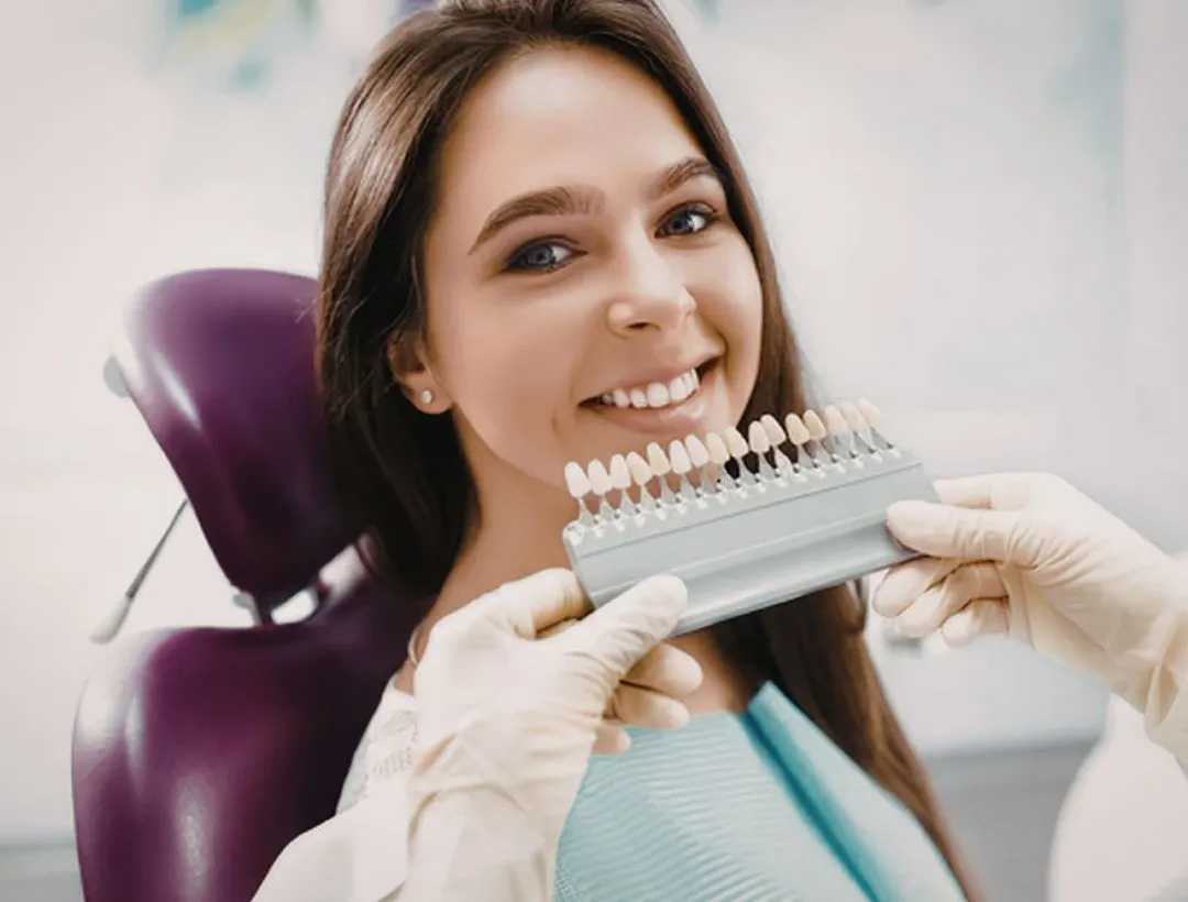 everything you need to know about porcelain veneers