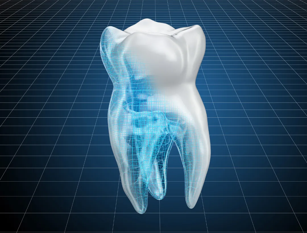 how to repair tooth enamel