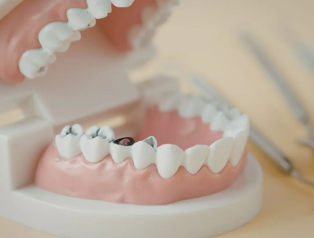 traditional dental implants vs immediate placement dental implants