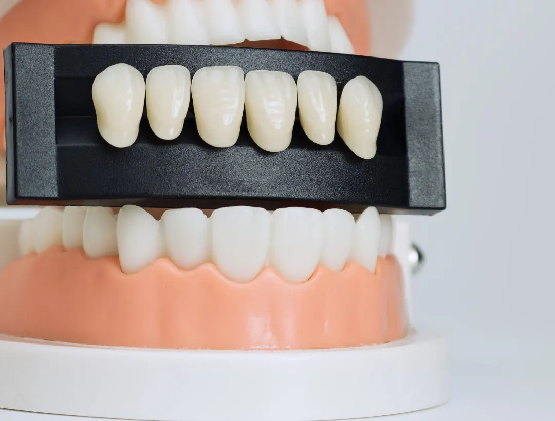 some facts you should know about porcelain veneer