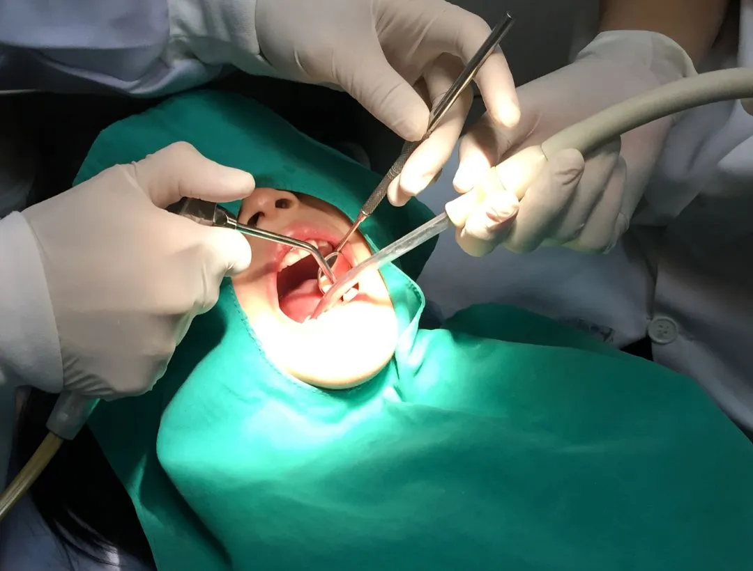 how to prepare for wisdom teeth removal