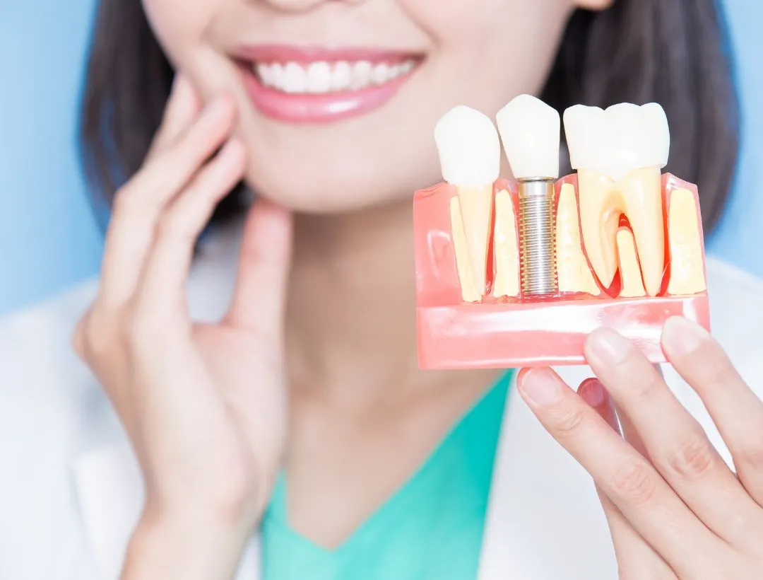full mouth reconstruction with implants
