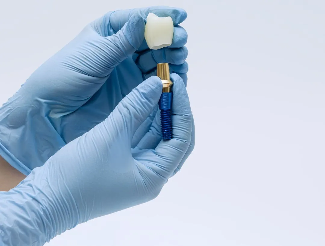 what to expect during a dental implant procedure