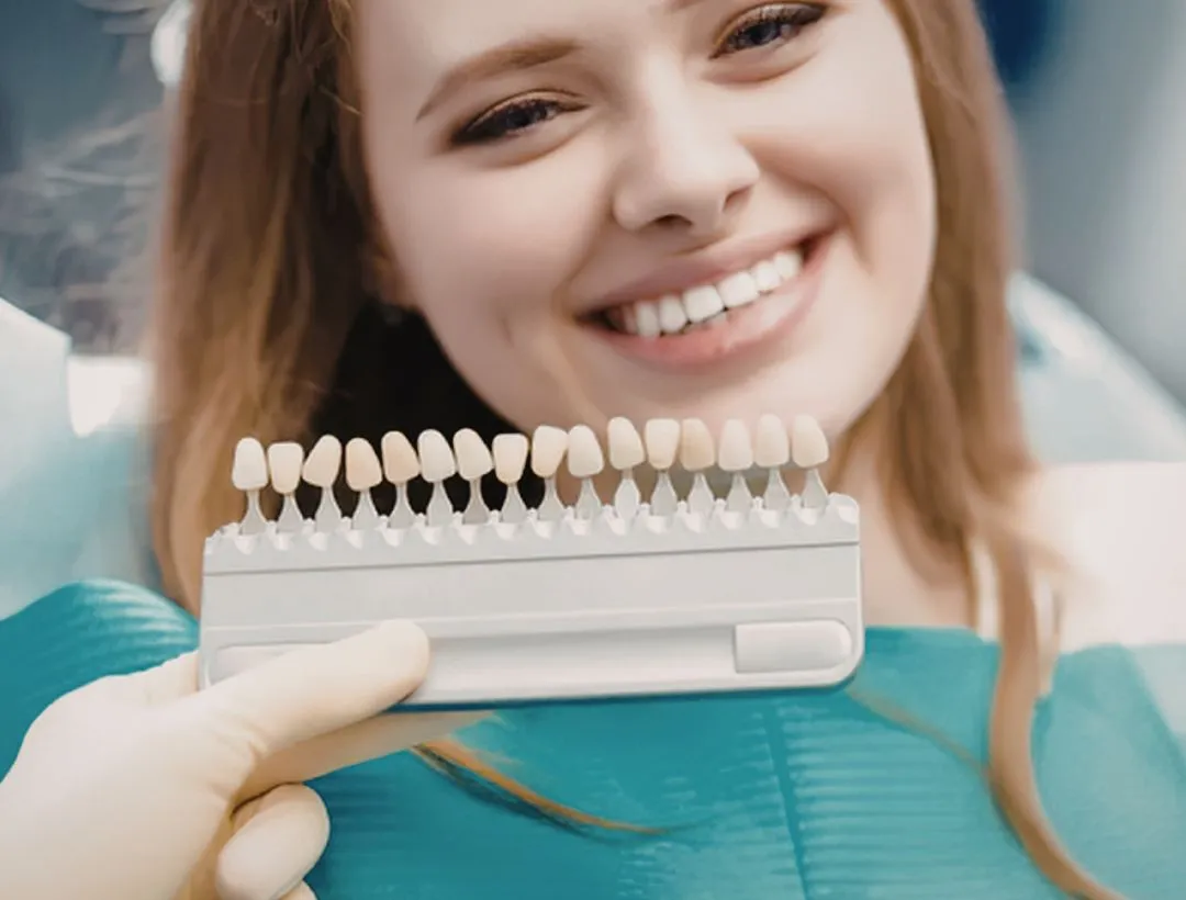 does insurance pay for veneers