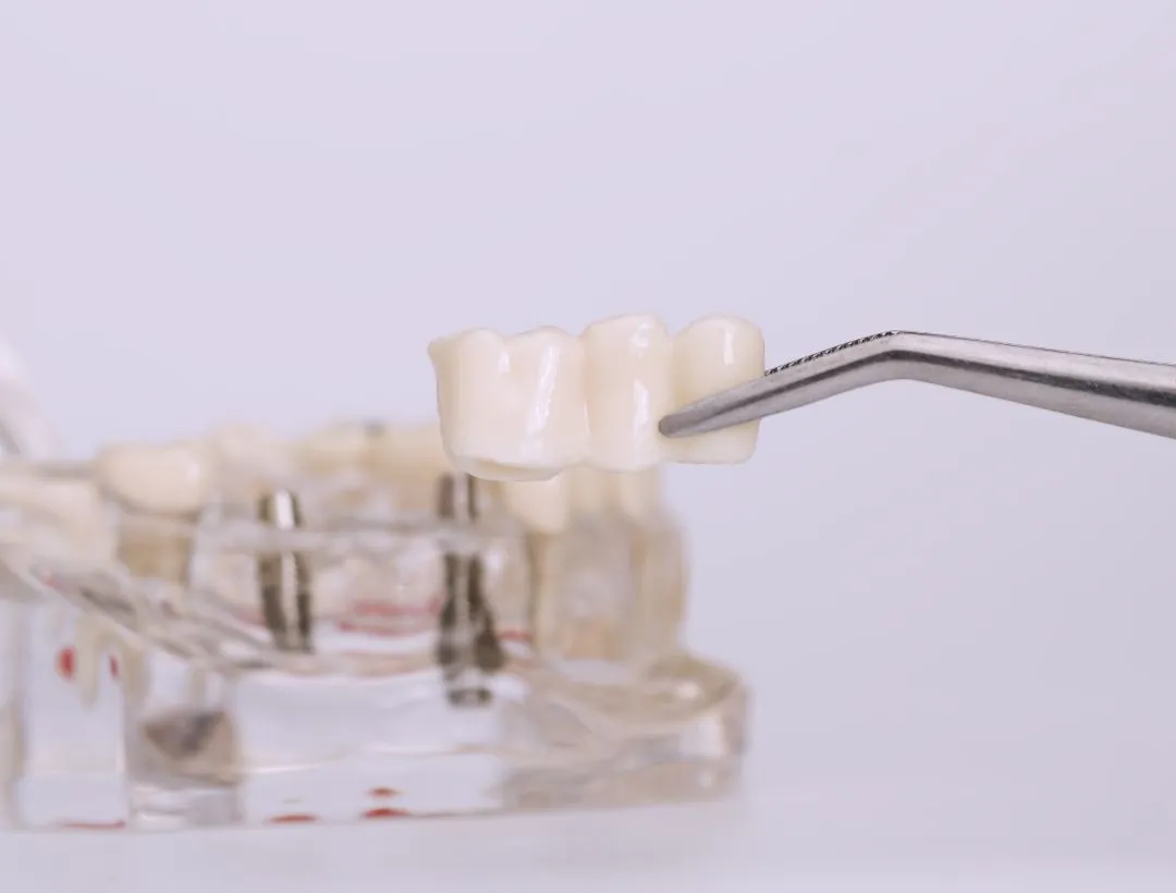 how much does dental insurance cover for a dental bridge?