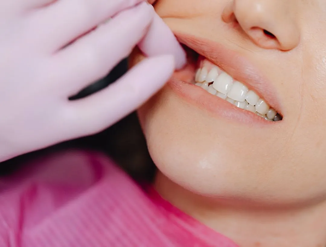 when is wisdom teeth removal necessary?