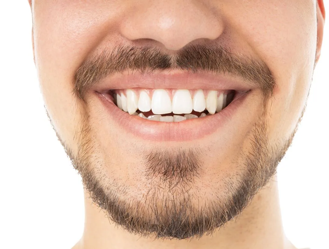 can you have a dental implant on a front tooth?