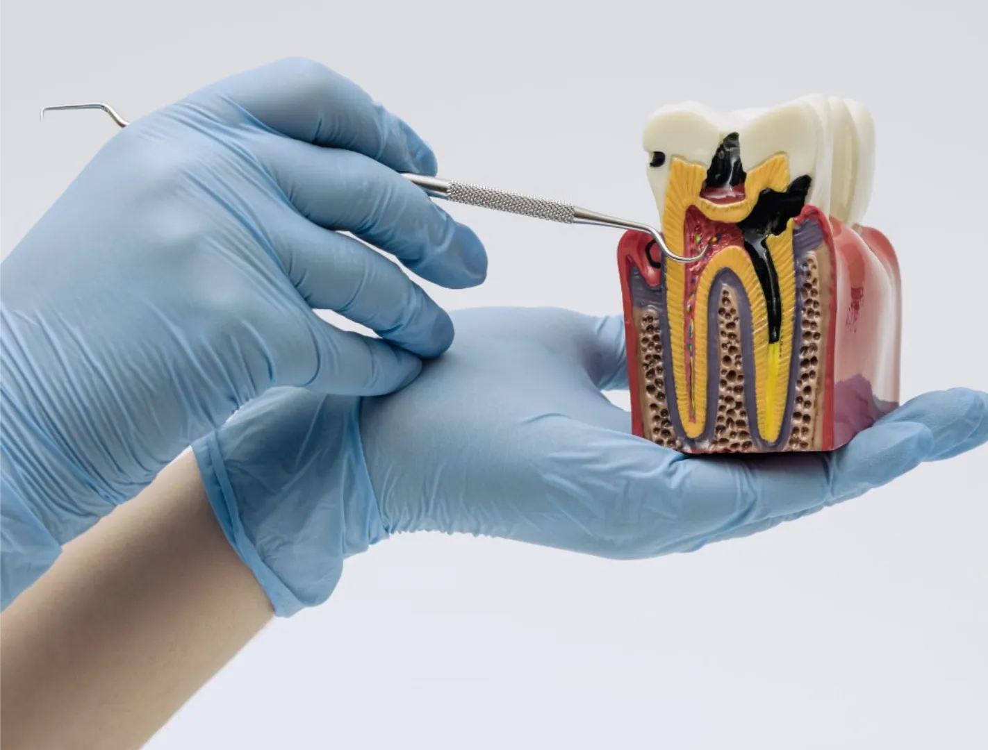 signs & symptoms of root canal treatment failure