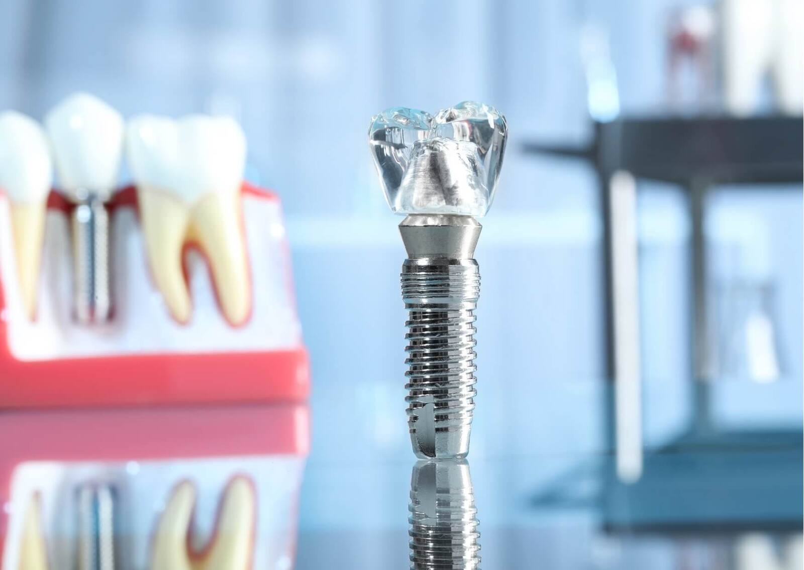 Dental implant model with implant-supported crown and surrounding teeth, illustrating factors that determine whether it is too late to get dental implants.