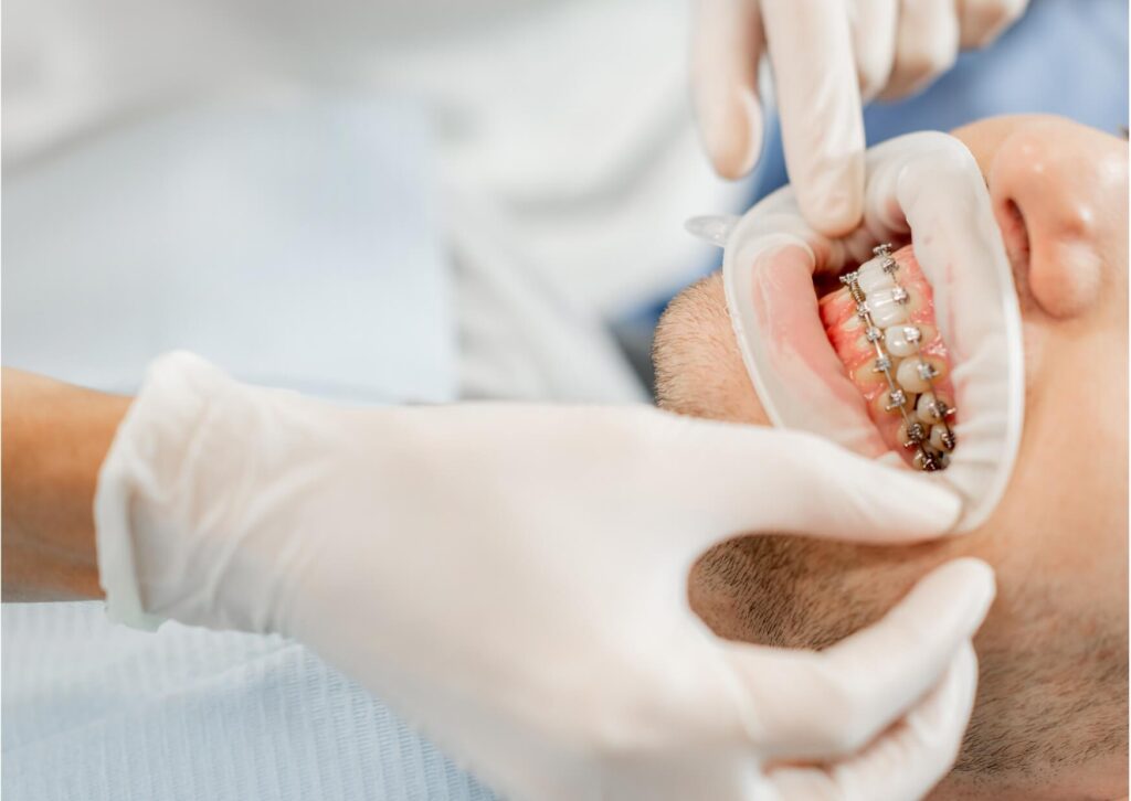 Orthodontist examining braces during a checkup after discussing whether it is safe to eat candy with braces.