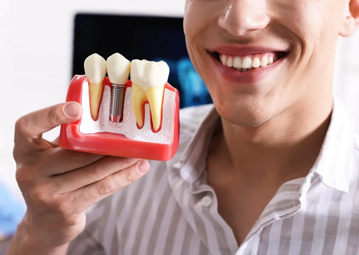 Dental implant model illustrating a replacement tooth while considering the pros and cons of dental implants.