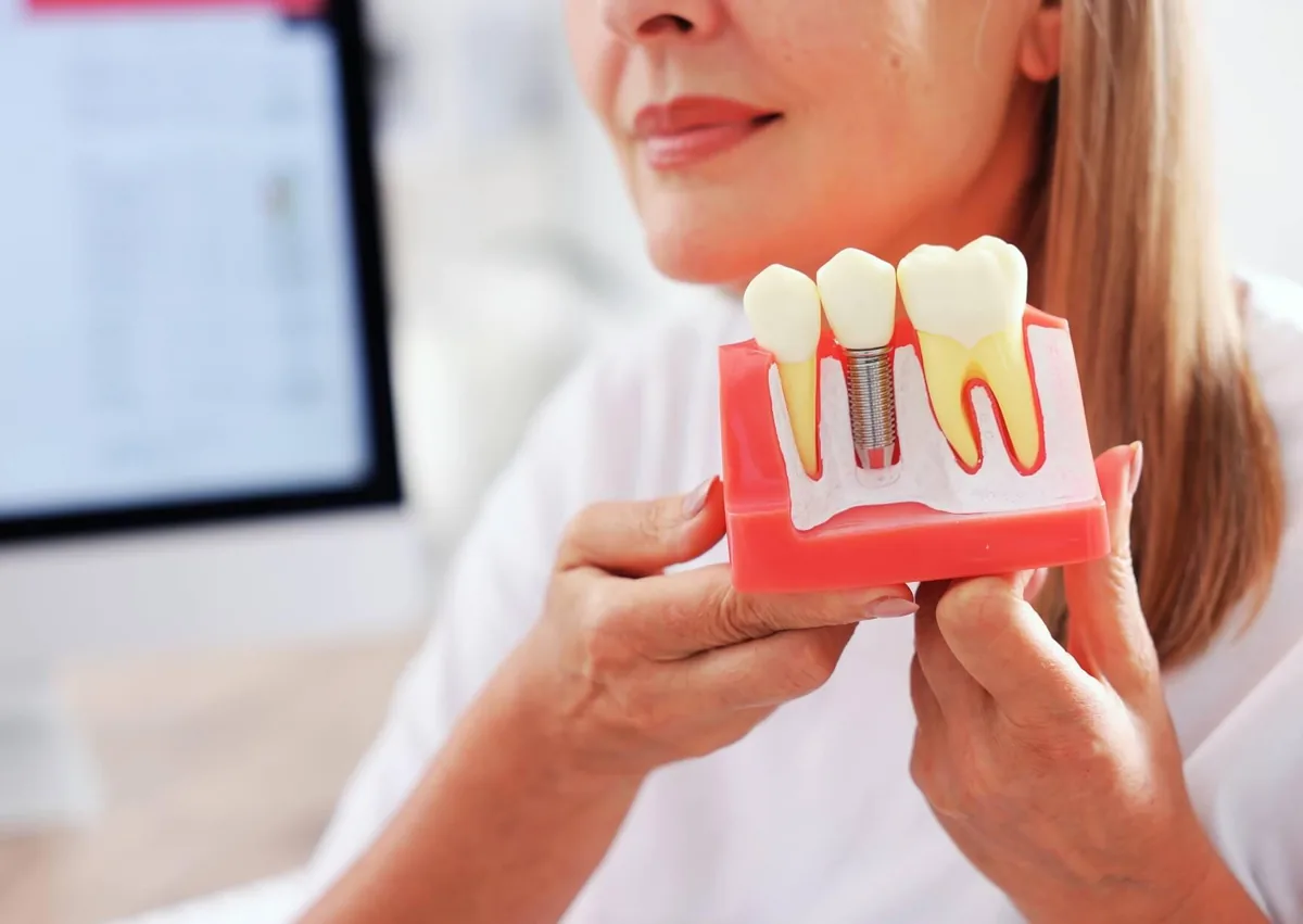 Dentist holding a dental implant model while explaining affordable dental implant options to a patient.
